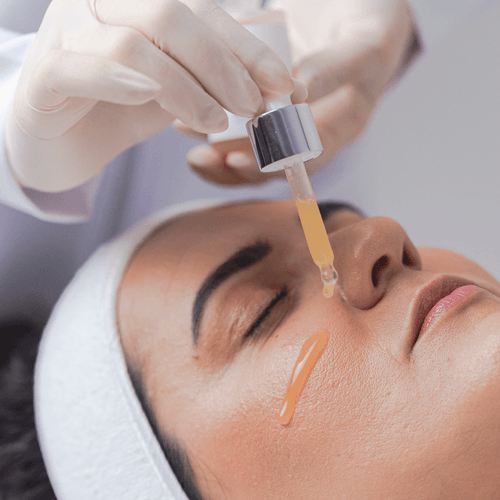 Peeling químico tranex peel 30 g