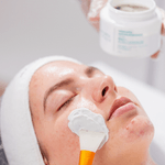 3287-facial-antiacne-kit-antiacne-profissional-5