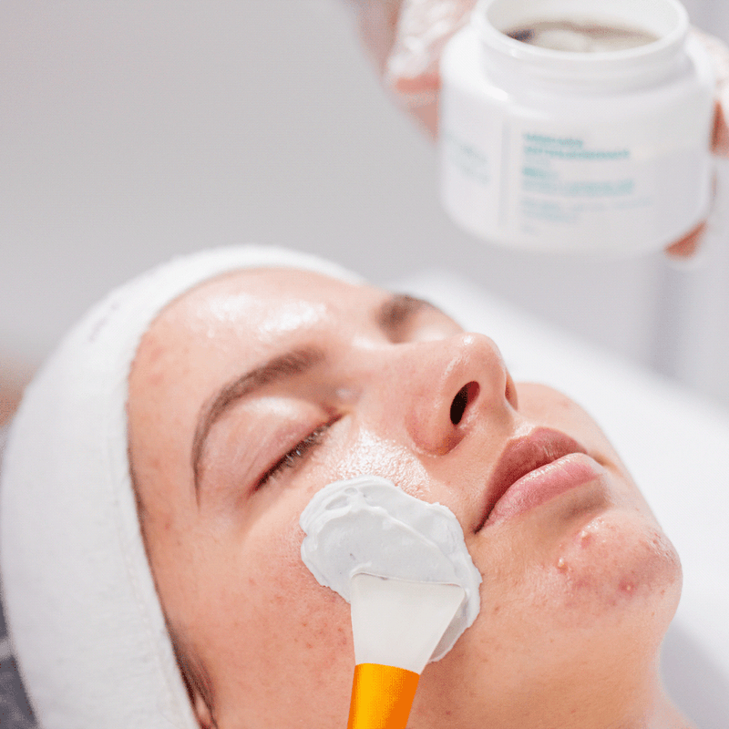 3287-facial-antiacne-kit-antiacne-profissional-5