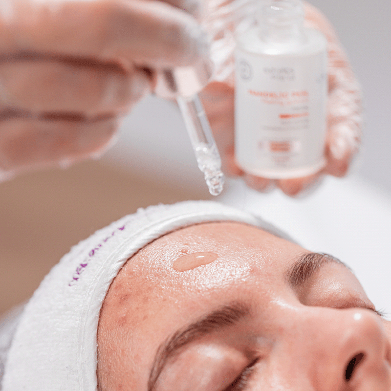 5154-facial-antiacne-kit-limpeza-de-pele-acneica-4