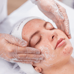 5154-facial-antiacne-kit-limpeza-de-pele-acneica-3