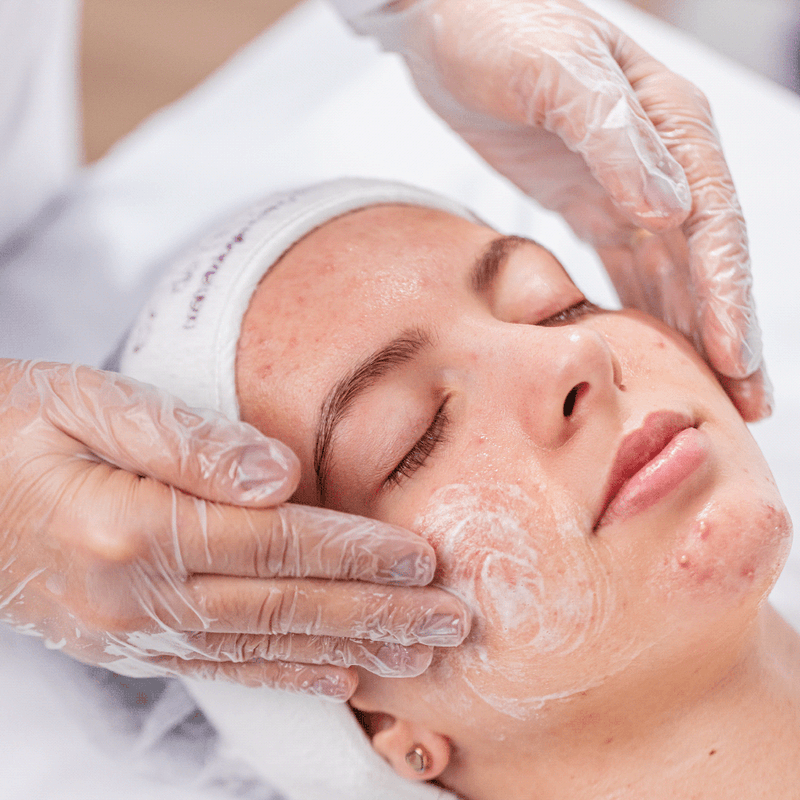 5154-facial-antiacne-kit-limpeza-de-pele-acneica-3