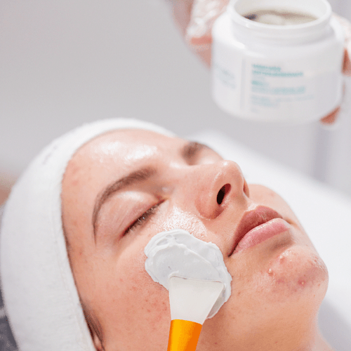 Kit Antiacne Profissional